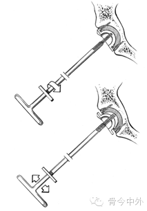 11.png 11.png